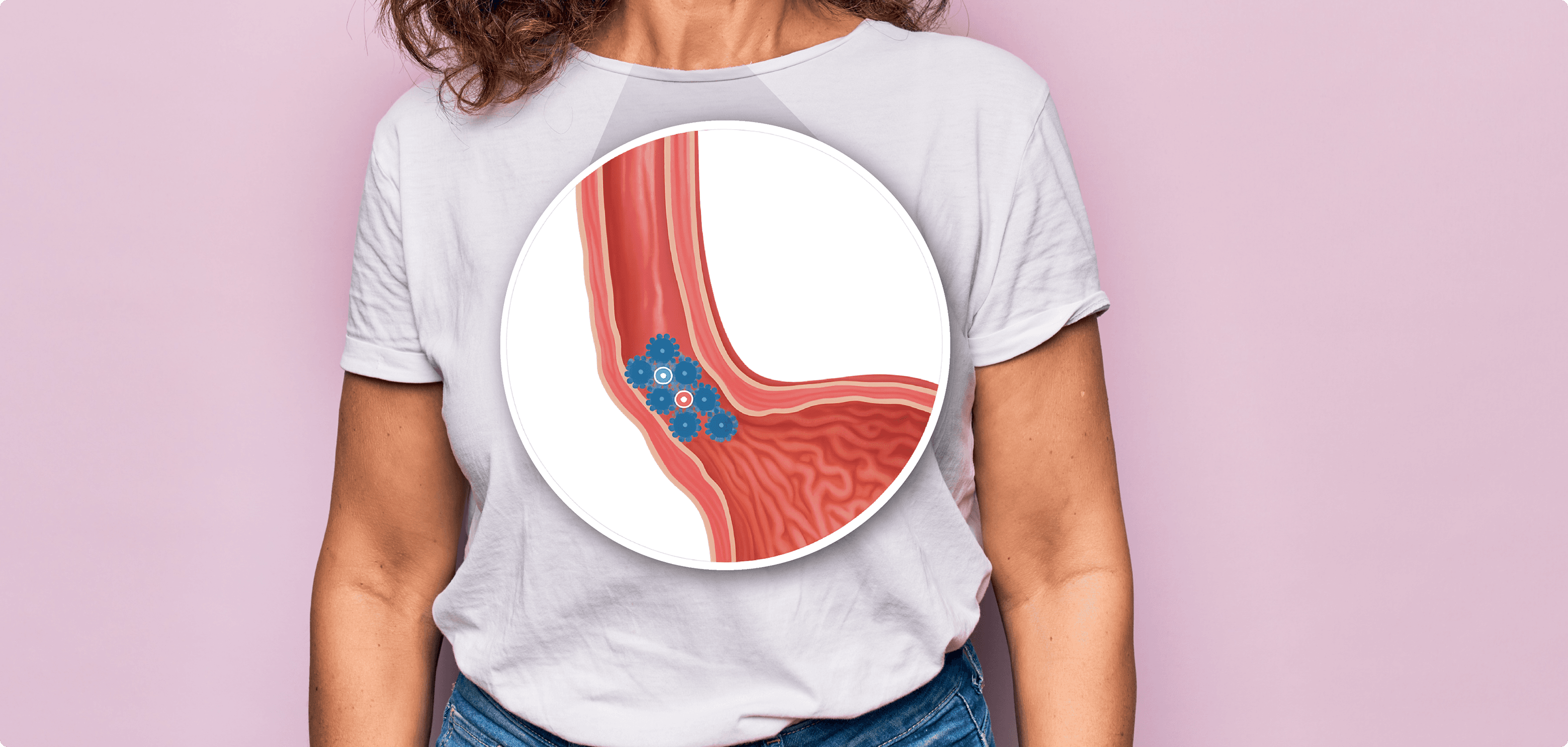 Reflusso gastroesofageo: Scopri il ruolo del Poloxamer 407
